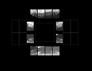 Alex 6 ans bzqclk - Eugenol