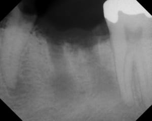 Avant ml8vbh - Eugenol