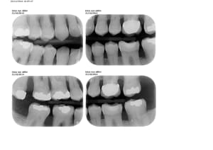 Bw 2014 xcpdcj - Eugenol