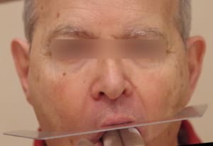 B face yjvtkh - Eugenol