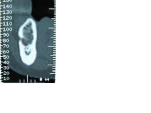 Boucle nai kg2qru - Eugenol