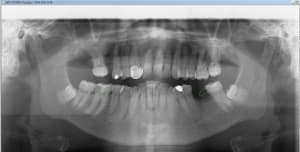 Bridge made in marocco 3 nkqaqc - Eugenol