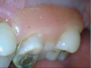 Bridge made in marocco y6s47d - Eugenol