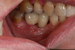 C9 re21hj - Eugenol