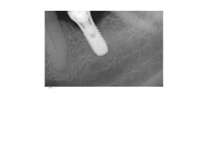 Camp2 uhqb1y - Eugenol