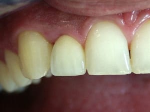 Ccc12sansflash omky55 - Eugenol