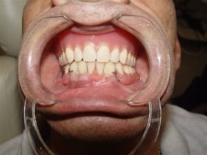 Cmu traitement terminé dup75k - Eugenol