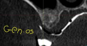 Capture1 l4rbab - Eugenol