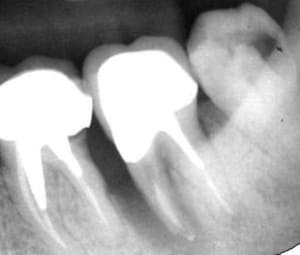 Capture2 puuiyv - Eugenol