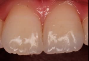 Capture d écran 2017 01 25 à 23.28 - Eugenol