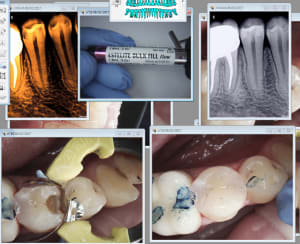 Capture d écran 2017 02 06 14.53 - Eugenol