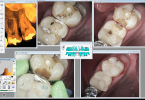 Capture d écran 2017 02 28 12.39 - Eugenol