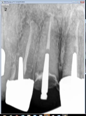 Capture d écran 2018 07 02 11.21 - Eugenol