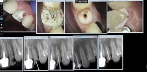 Capture d écran 2019 01 09 15.25 - Eugenol