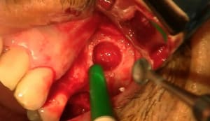 Capture du4brr - Eugenol