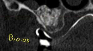 Capture gawpu3 - Eugenol