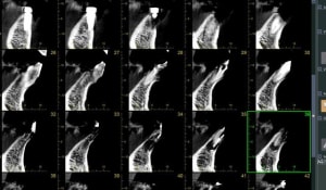 Capture morita 2 stjceh - Eugenol