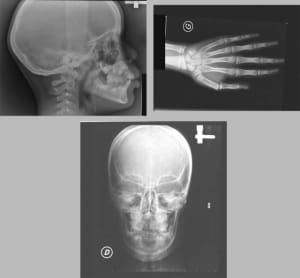 Cas 1 jpdxam - Eugenol