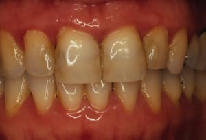 Copie de avt brossage zee5jn - Eugenol