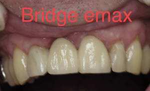 D278a3c7 e576 47f6 86be c6e6ff2c84d2 elkx4b - Eugenol