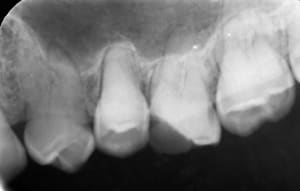 D9f30056 befd 4a58 a9d3 44fed132d3d4 zi8p3v - Eugenol