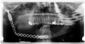 Dc tw3uid - Eugenol