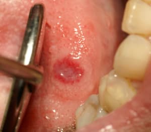 Dsc00455 gy3qlm - Eugenol