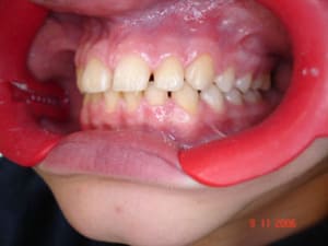 Dsc00926 nj4c0x - Eugenol