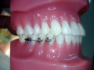 Dsc01002 jlwaau - Eugenol