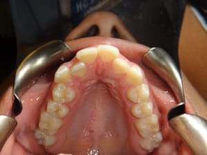 Dsc01042 lv8u88 - Eugenol
