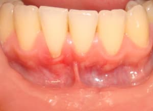 Dsc01146 m3lwqw - Eugenol