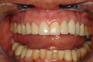 Dscf0072 qgh8md - Eugenol