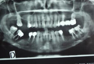 Dscf0313  2  dfzqwj - Eugenol