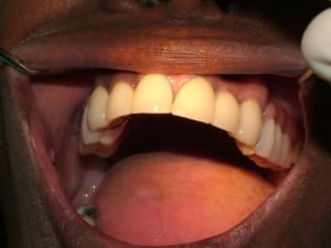 Dscf0630 m6m2rc - Eugenol