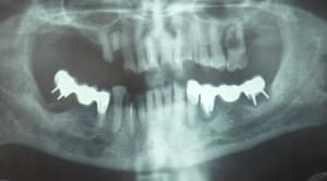 Dscf0823  2  mqzt1z - Eugenol