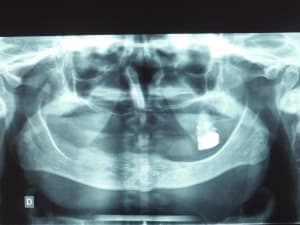 Dscf1629 2 iuaamj - Eugenol