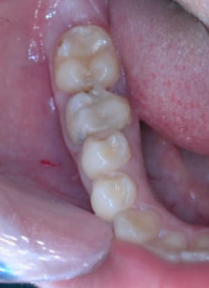 Dscn0339 zbzs6n - Eugenol