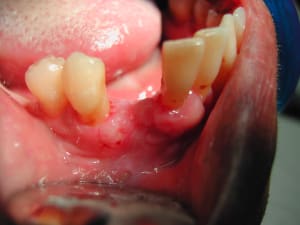 Dscn0419 wbycsp - Eugenol