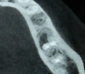 Dscn0464 xmibca - Eugenol