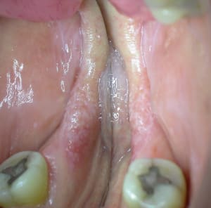 Dscn1046 qgjnj0 - Eugenol