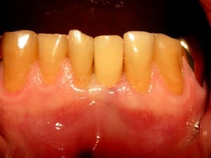 Dscn1047bis pnngyq - Eugenol