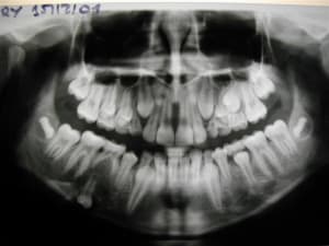 Dscn1483  small   2  nzvrxs - Eugenol