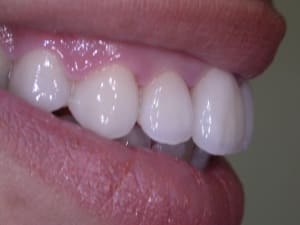 Dscn1800 satfna - Eugenol