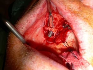 Dscn1823 z7krvp - Eugenol