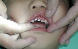 Dscn1842 1 qnk59l - Eugenol