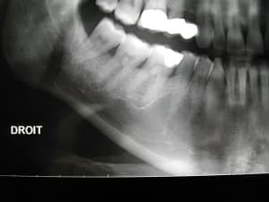 Dscn1956 zire1n - Eugenol