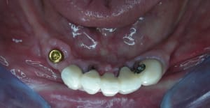 Dscn1998 kfatz6 - Eugenol