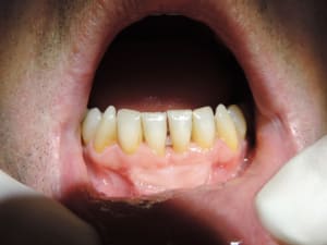 Dscn2459 czyv6r - Eugenol