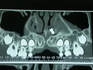 Dscn2556 zq9usn - Eugenol