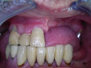 Dscn2601 crjpg9 - Eugenol